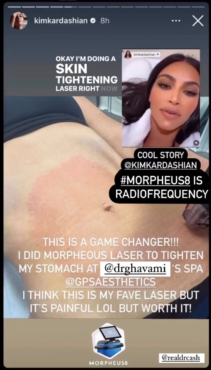 MORPHEUS 8